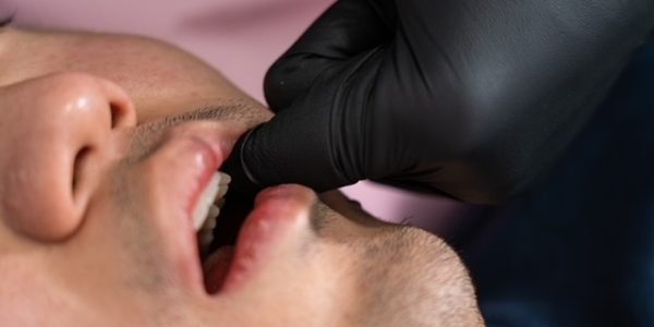Intra-Oral TMJ or Jaw Massage (Therapy) in Downtown Vancouver